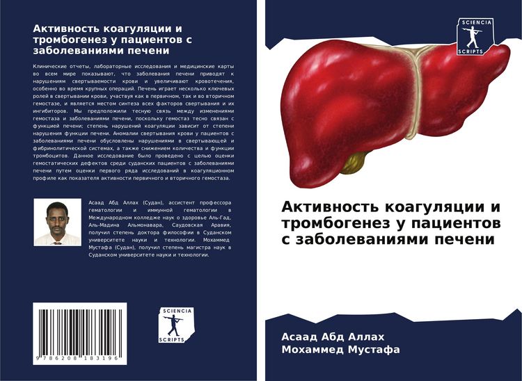 Produktbild: Aktiwnost' koagulqcii i trombogenez u pacientow s zabolewaniqmi pecheni