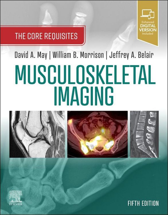 Produktbild: Musculoskeletal Imaging