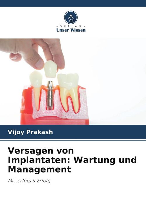 Produktbild: Versagen von Implantaten: Wartung und Management