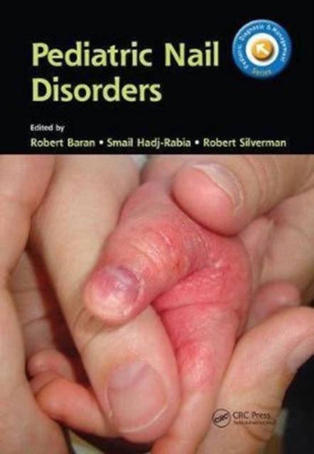 Produktbild: Pediatric Nail Disorders
