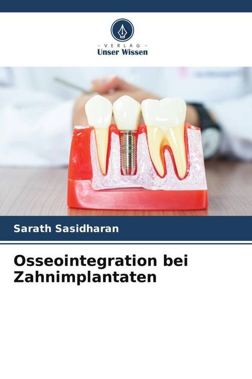 Produktbild: Osseointegration bei Zahnimplantaten