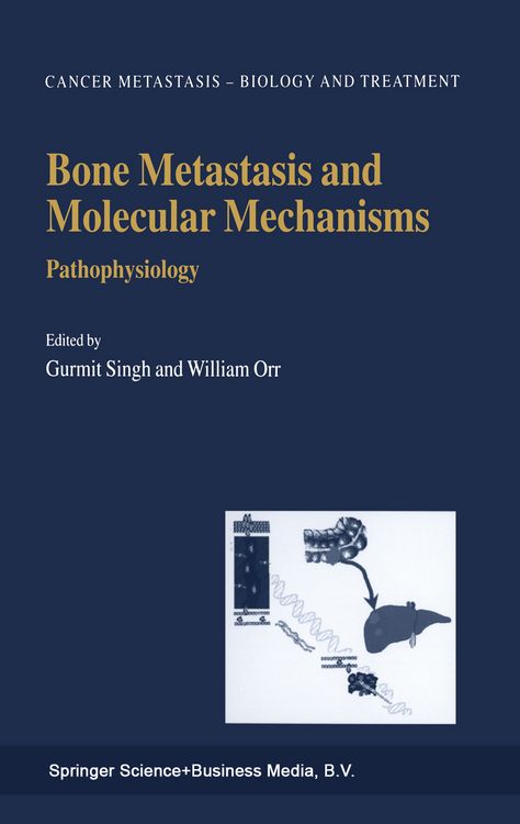 Produktbild: Bone Metastasis and Molecular Mechanisms