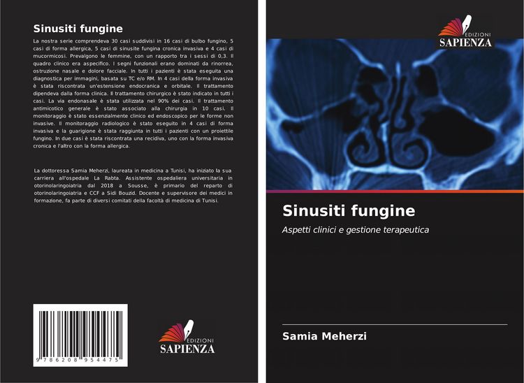 Produktbild: Sinusiti fungine