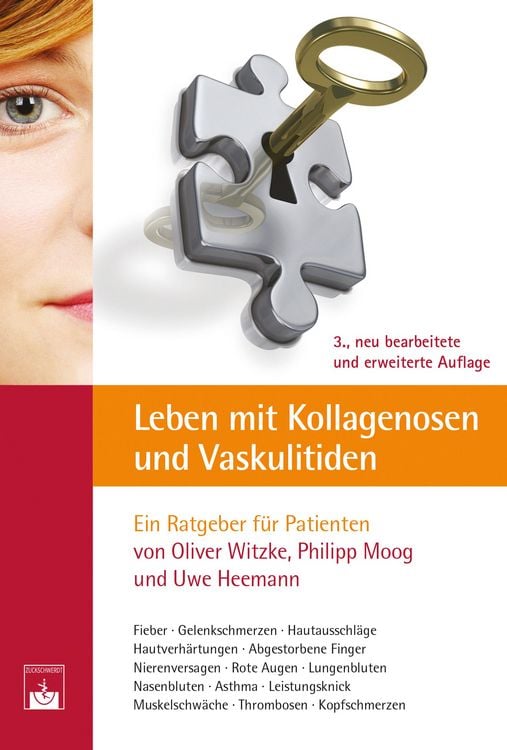 Produktbild: Leben mit Kollagenosen und Vaskulitiden
