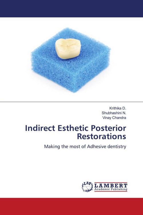 Produktbild: Indirect Esthetic Posterior Restorations