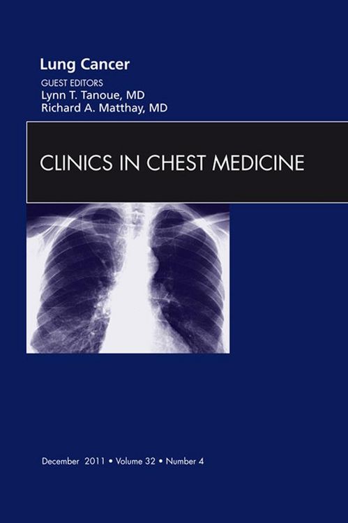 Produktbild: Lung Cancer, An Issue of Clinics in Chest Medicine