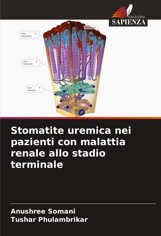 Produktbild: Stomatite uremica nei pazienti con malattia renale allo stadio terminale