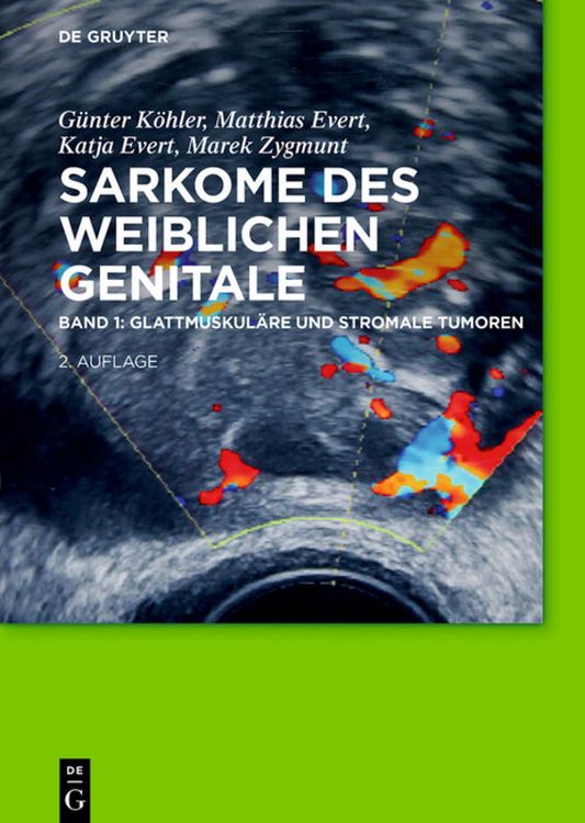 Produktbild: Glattmuskul&auml;re und stromale Tumoren