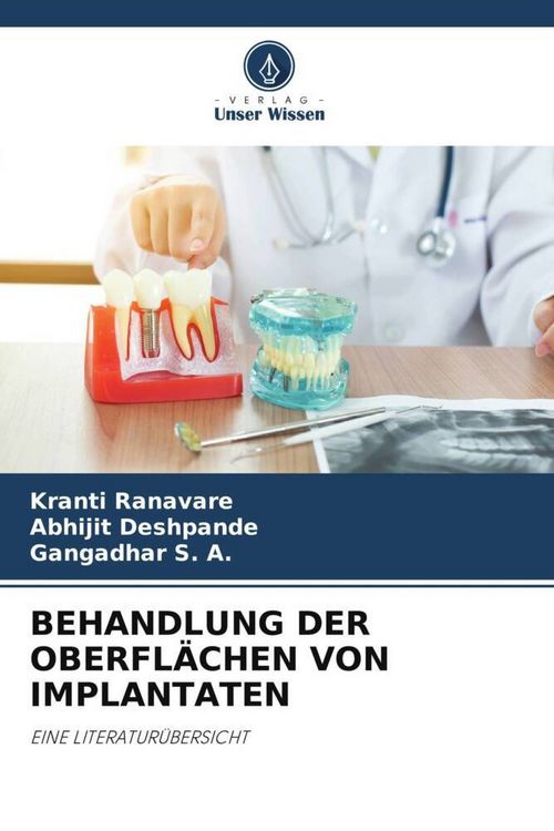 Produktbild: Behandlung der Oberfl&auml;chen von Implantaten