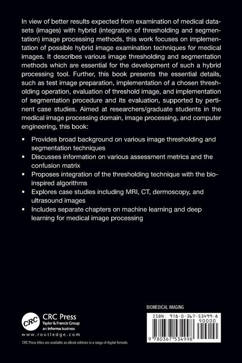 Produktbild: Hybrid Image Processing Methods for Medical Image Examination