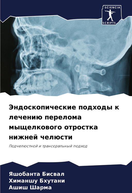 Produktbild: Jendoskopicheskie podhody k lecheni&uuml; pereloma myschelkowogo otrostka nizhnej chel&uuml;sti