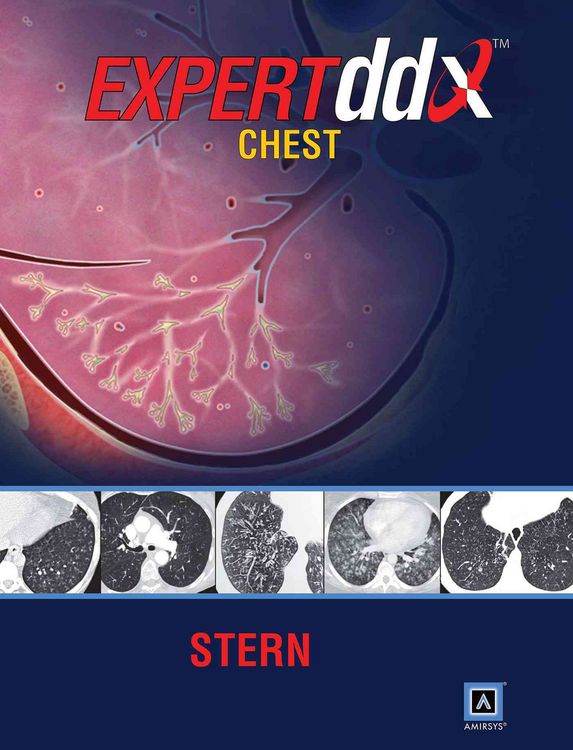 Produktbild: Kicska, G: EXPERTddx: Chest