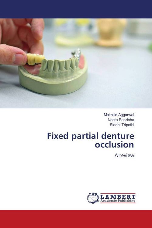 Produktbild: Fixed partial denture occlusion