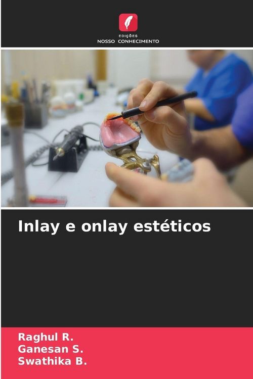 Produktbild: Inlay e onlay est&eacute;ticos