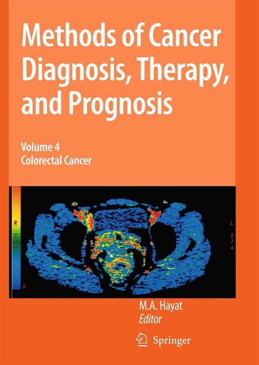 Produktbild: Methods of Cancer Diagnosis, Therapy and Prognosis