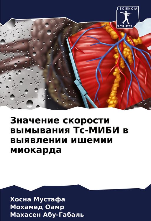 Produktbild: Znachenie skorosti wymywaniq Ts-MIBI w wyqwlenii ishemii miokarda