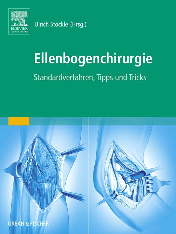 Produktbild: Ellenbogenchirurgie