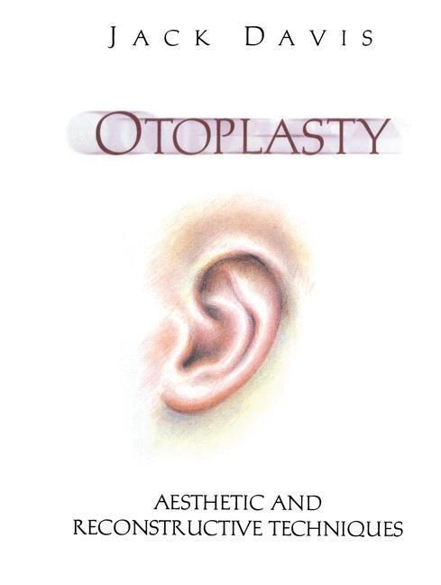Produktbild: Otoplasty