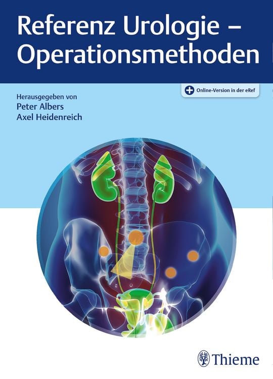 Produktbild: Referenz Urologie - Operationsmethoden