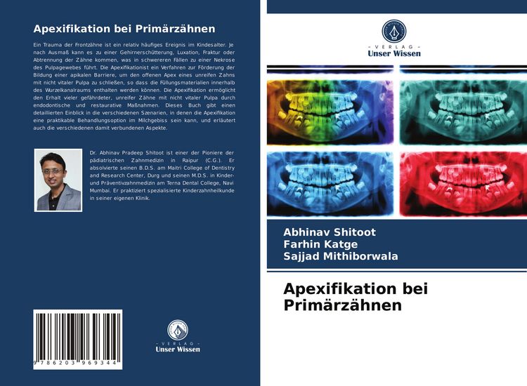 Produktbild: Apexifikation bei Prim&auml;rz&auml;hnen