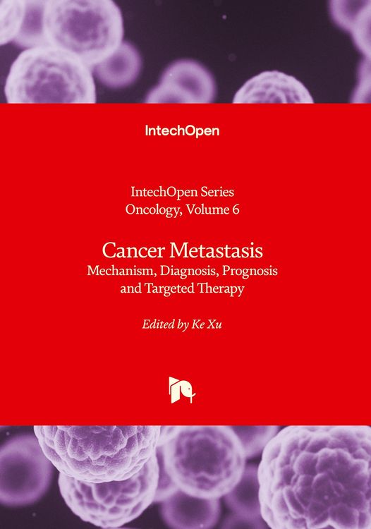Produktbild: Cancer Metastasis - Mechanism, Diagnosis, Prognosis and Targeted Therapy