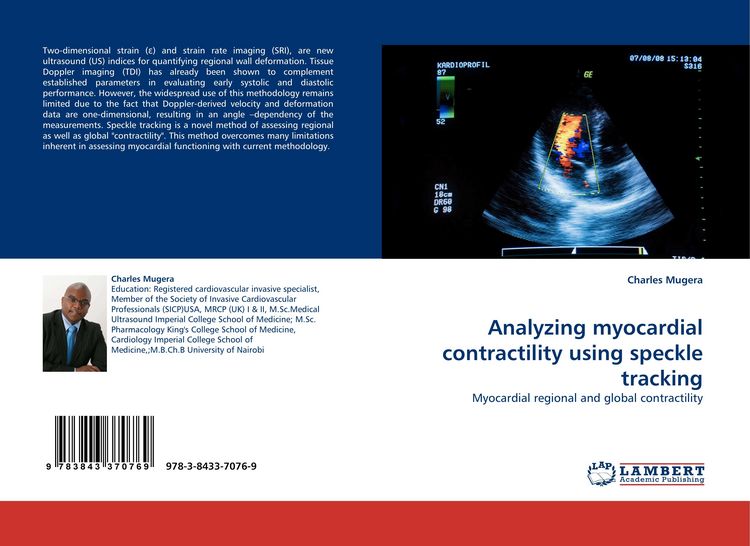 Produktbild: Analyzing myocardial contractility using speckle tracking