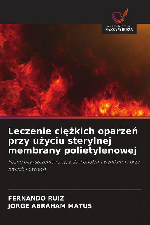 Produktbild: Leczenie ci&iquest;&iquest;kich oparze&iquest; przy u&iquest;yciu sterylnej membrany polietylenowej