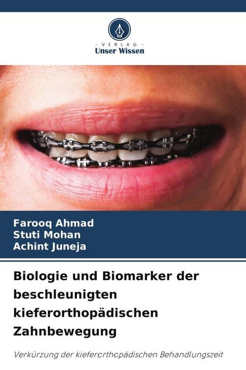 Produktbild: Biologie und Biomarker der beschleunigten kieferorthop&auml;dischen Zahnbewegung
