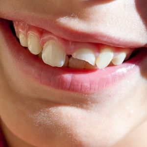 Produktbild: Smiling Through The Pain