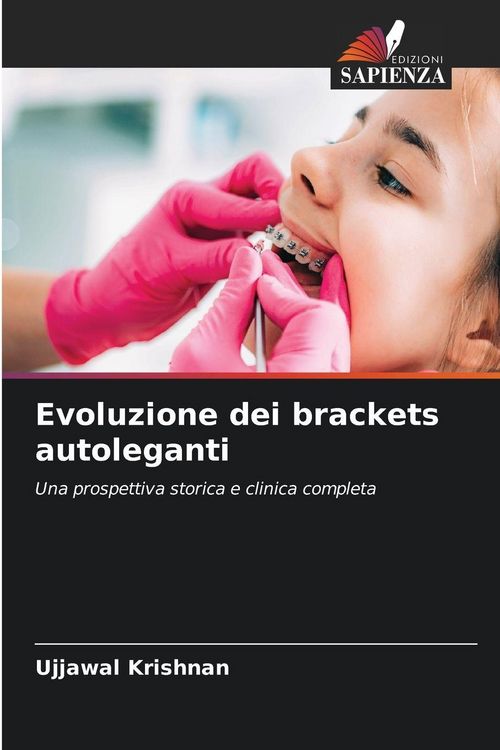 Produktbild: Evoluzione dei brackets autoleganti