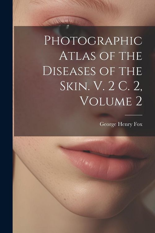 Produktbild: Photographic Atlas of the Diseases of the Skin. V. 2 C. 2, Volume 2