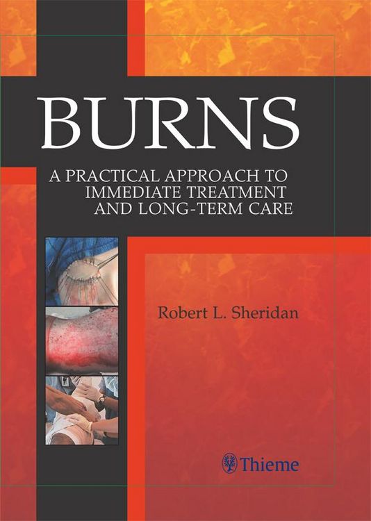 Produktbild: Burns