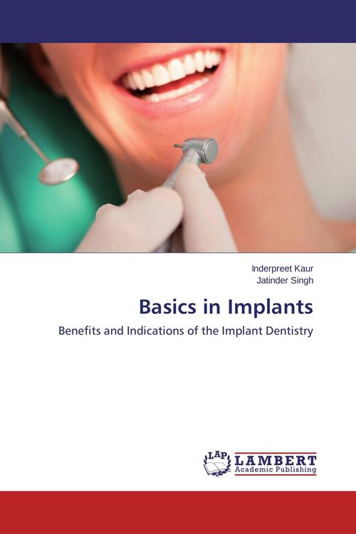 Produktbild: Basics in Implants