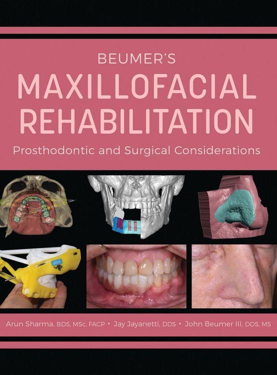 Produktbild: Beumer's Maxillofacial Rehabilitation