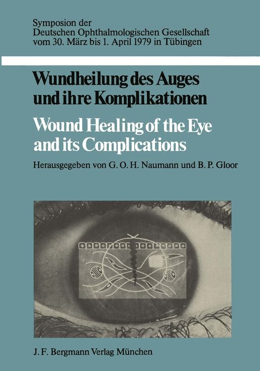 Produktbild: Wundheilung des Auges und ihre Komplikationen / Wound Healing of the Eye and its Complications