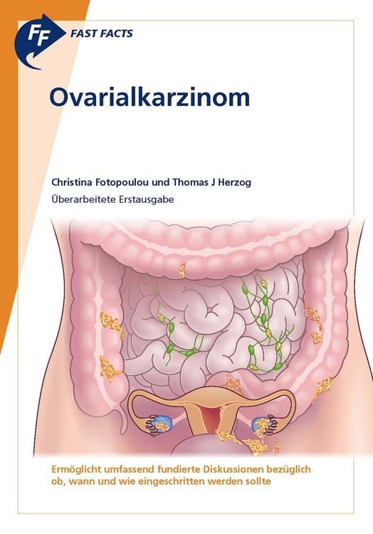 Produktbild: Fast Facts: Ovarialkarzinom