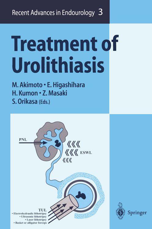 Produktbild: Treatment of Urolithiasis