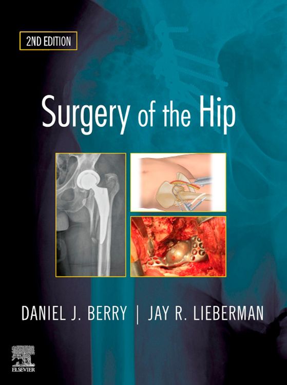 Produktbild: Surgery of the Hip