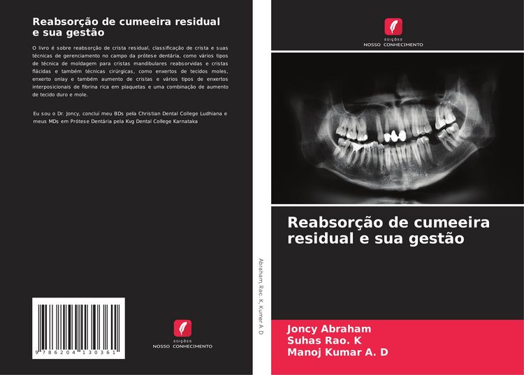 Produktbild: Reabsor&ccedil;&atilde;o de cumeeira residual e sua gest&atilde;o