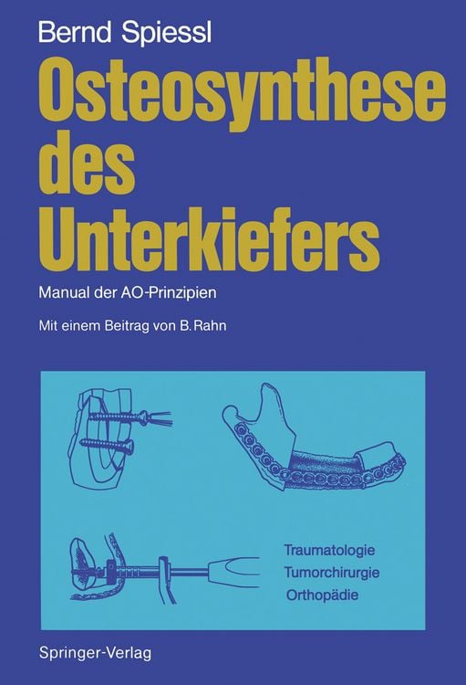 Produktbild: Osteosynthese des Unterkiefers