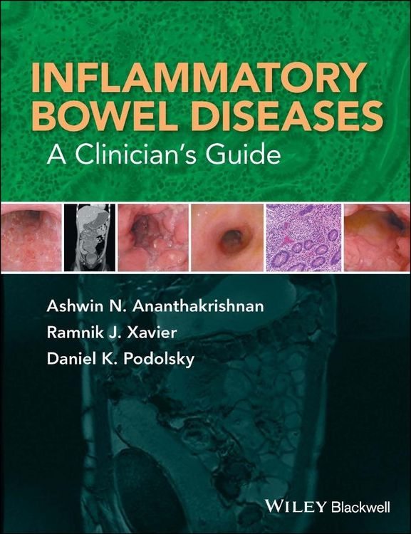 Produktbild: Inflammatory Bowel Diseases