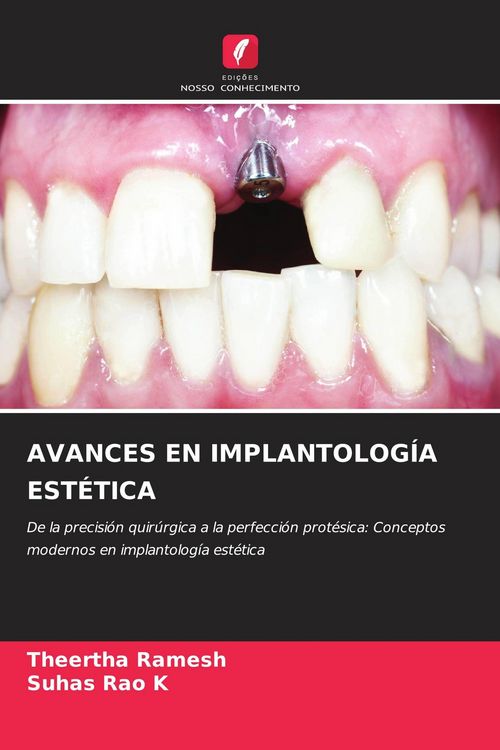 Produktbild: Avances En Implantolog&iacute;a Est&eacute;tica
