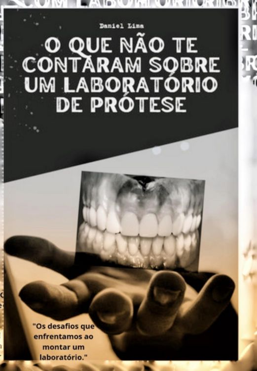 Produktbild: O Que N&atilde;o Te Contaram Sobre Um Laborat&oacute;rio De Pr&oacute;tese