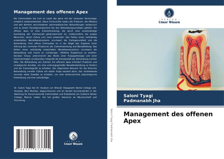 Produktbild: Management des offenen Apex