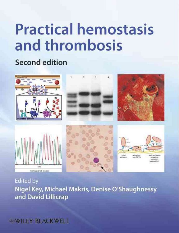 Produktbild: Practical Hemostasis and Thrombosis