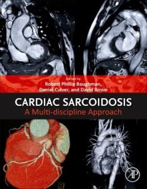 Produktbild: Cardiac Sarcoidosis