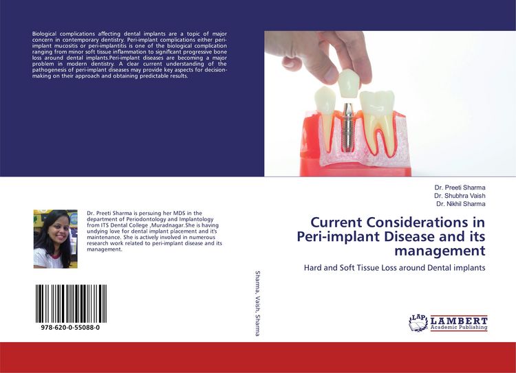 Produktbild: Current Considerations in Peri-implant Disease and its management