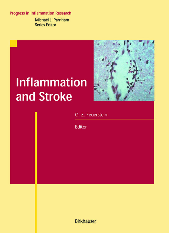 Produktbild: Inflammation and Stroke
