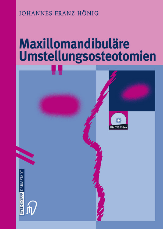 Produktbild: Maxillomandibul&auml;re Umstellungsosteotomien