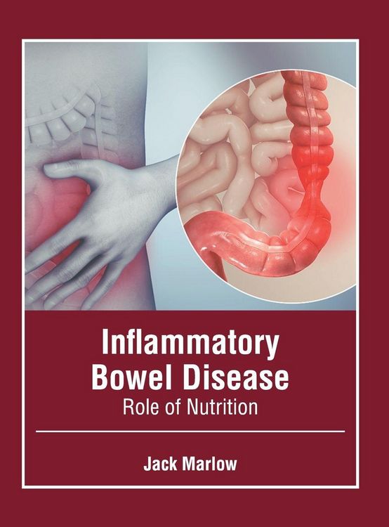 Produktbild: Inflammatory Bowel Disease: Role of Nutrition